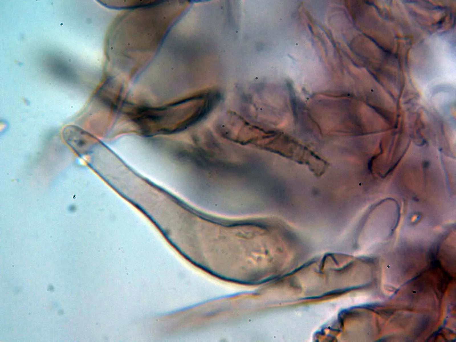 Microscopía de Simocybe centunculus - 10 - Cutícula 4